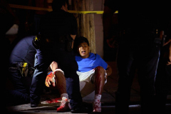 Bronx man shot in the arm