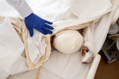 A doctor showing what was left of a leg that was amputated from a Ukraininan soldier in Mechnikov Hospital in Dnipro, Ukraine on Sunday, May 14, 2023.